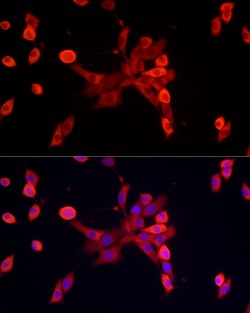 Invitrogen S100A10 Recombinant Rabbit Monoclonal Antibody (6A4Z3) 100 &mu;L;