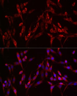 Invitrogen S100A10 Recombinant Rabbit Monoclonal Antibody (6A4Z3) 100 &mu;L;