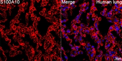 Invitrogen S100A10 Recombinant Rabbit Monoclonal Antibody (6A4Z3) 100 &mu;L;