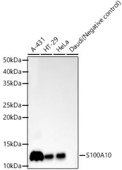 Invitrogen S100A10 Recombinant Rabbit Monoclonal Antibody (6A4Z3) 100 &mu;L;