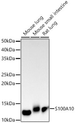 Invitrogen S100A10 Recombinant Rabbit Monoclonal Antibody (6A4Z3) 100 &mu;L;