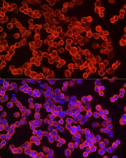 Invitrogen eIF4A1 Recombinant Rabbit Monoclonal Antibody (3T7U10) 100 &mu;L;