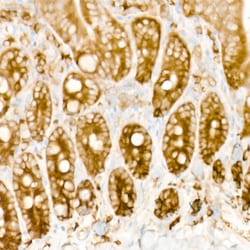 Invitrogen eIF4A1 Recombinant Rabbit Monoclonal Antibody (3T7U10) 100 &mu;L;