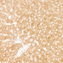 Invitrogen eIF4A1 Recombinant Rabbit Monoclonal Antibody (3T7U10) 100 &mu;L;