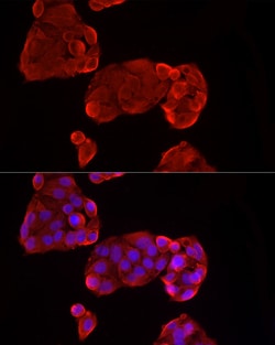 Invitrogen Glypican 3 Recombinant Rabbit Monoclonal Antibody (7K5V6) 100