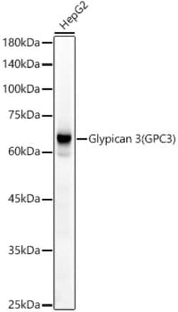 Invitrogen Glypican 3 Recombinant Rabbit Monoclonal Antibody (7K5V6) 100