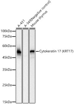 Invitrogen Cytokeratin 17 Recombinant Rabbit Monoclonal Antibody (4G2I7) 100 &mu;L | Buy Online | Invitrogen&trade; | Fisher Scientific