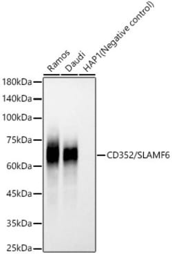 Invitrogen Ly-108 Recombinant Rabbit Monoclonal Antibody (4R6M4) 100 &mu;L;
