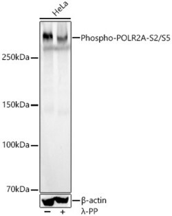 Invitrogen Phospho-RNA pol II CTD (Ser2, Ser5) Recombinant Rabbit Monoclonal