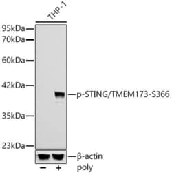 Invitrogen Phospho-STING (Ser366) Recombinant Rabbit Monoclonal Antibody
