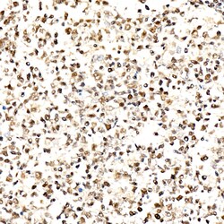 Invitrogen Phospho-AKT Pan (Thr450, Thr451, Thr447) Recombinant Rabbit