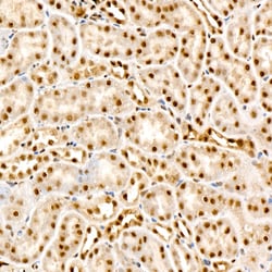 Invitrogen Phospho-AKT Pan (Thr450, Thr451, Thr447) Recombinant Rabbit