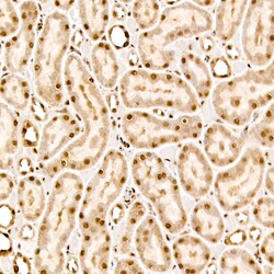 Invitrogen Phospho-AKT Pan (Thr450, Thr451, Thr447) Recombinant Rabbit