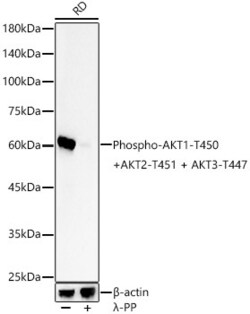 Invitrogen Phospho-AKT Pan (Thr450, Thr451, Thr447) Recombinant Rabbit