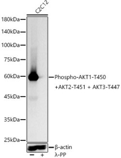 Invitrogen Phospho-AKT Pan (Thr450, Thr451, Thr447) Recombinant Rabbit