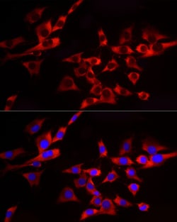 Invitrogen EIF4A1/EIF4A2/EIF4A3 Recombinant Rabbit Monoclonal Antibody