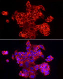 Invitrogen EIF4A1/EIF4A2/EIF4A3 Recombinant Rabbit Monoclonal Antibody