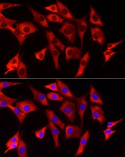 Invitrogen EIF4A1/EIF4A2/EIF4A3 Recombinant Rabbit Monoclonal Antibody