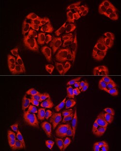 Invitrogen EIF4A1/EIF4A2/EIF4A3 Recombinant Rabbit Monoclonal Antibody