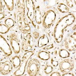 Invitrogen EIF4A1/EIF4A2/EIF4A3 Recombinant Rabbit Monoclonal Antibody