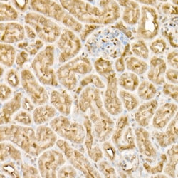 Invitrogen EIF4A1/EIF4A2/EIF4A3 Recombinant Rabbit Monoclonal Antibody