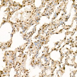 Invitrogen EIF4A1/EIF4A2/EIF4A3 Recombinant Rabbit Monoclonal Antibody