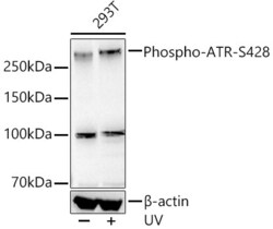 Invitrogen Phospho-ATR (Ser428) Recombinant Rabbit Monoclonal Antibody