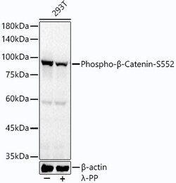 Invitrogen Phospho-beta Catenin (Ser552) Recombinant Rabbit Monoclonal