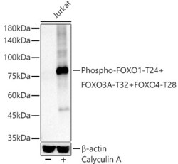 Invitrogen Phospho-FOXO1/FOXO3/FOXO4 (Thr24, Thr32, Thr28) Recombinant