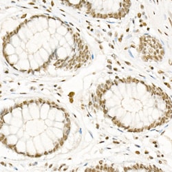 Invitrogen Phospho-CDK2 (Thr160) Recombinant Rabbit Monoclonal Antibody (8W3U2) 100 &mu;L | Buy Online | Invitrogen&trade; | Fisher Scientific