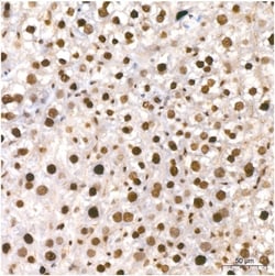 Invitrogen Phospho-CDK2 (Thr160) Recombinant Rabbit Monoclonal Antibody (8W3U2) 100 &mu;L | Buy Online | Invitrogen&trade; | Fisher Scientific