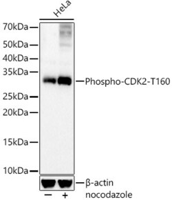 Invitrogen Phospho-CDK2 (Thr160) Recombinant Rabbit Monoclonal Antibody (8W3U2) 100 &mu;L | Buy Online | Invitrogen&trade; | Fisher Scientific