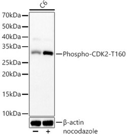 Invitrogen Phospho-CDK2 (Thr160) Recombinant Rabbit Monoclonal Antibody (8W3U2) 100 &mu;L | Buy Online | Invitrogen&trade; | Fisher Scientific