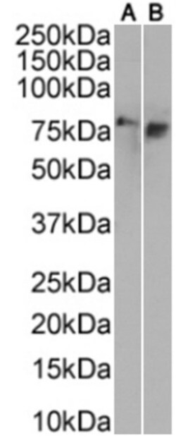 Invitrogen&trade;&nbsp;Tau Oligomeric Complex Chimeric Recombinant Rabbit Monoclonal Antibody (TOC1)