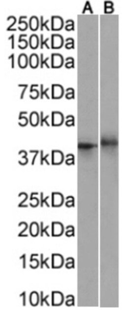 Invitrogen&trade;&nbsp;CD137 Chimeric Recombinant Rabbit Monoclonal Antibody (BBK4)