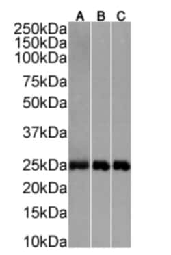 Invitrogen&trade;&nbsp;CD3e Chimeric Recombinant Rabbit Monoclonal Antibody (898H2-6-15)