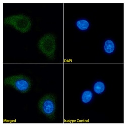 Invitrogen&trade;&nbsp;CD56 Chimeric Recombinant Rabbit Monoclonal Antibody (N901)