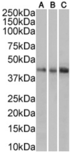 Invitrogen&trade;&nbsp;TRAIL-R2 (DR5) Chimeric Recombinant Rabbit Monoclonal Antibody (304)