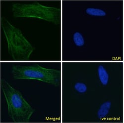 Invitrogen&trade;&nbsp;Nimotuzumab Chimeric Recombinant Rabbit Monoclonal Antibody (h-R3 (Nimotuzumab))
