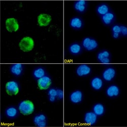 Invitrogen&trade;&nbsp;NKG2D Chimeric Recombinant Rabbit Monoclonal Antibody (6E5A7)