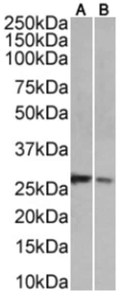 Invitrogen&trade;&nbsp;NKG2D Chimeric Recombinant Rabbit Monoclonal Antibody (6E5A7)