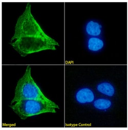 Invitrogen&trade;&nbsp;MUC1 Chimeric Recombinant Mouse Monoclonal Antibody (AR20.5)