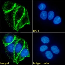Invitrogen CEA Chimeric Recombinant Rabbit Monoclonal Antibody (EB-022)