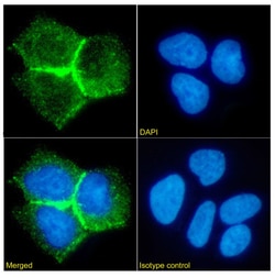Invitrogen&trade;&nbsp;CEA Chimeric Recombinant Rabbit Monoclonal Antibody (BW431/26)