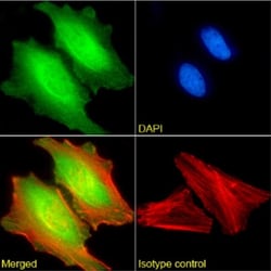 Invitrogen&trade;&nbsp;MAGEA3 Chimeric Recombinant Rabbit Monoclonal Antibody (21B4)