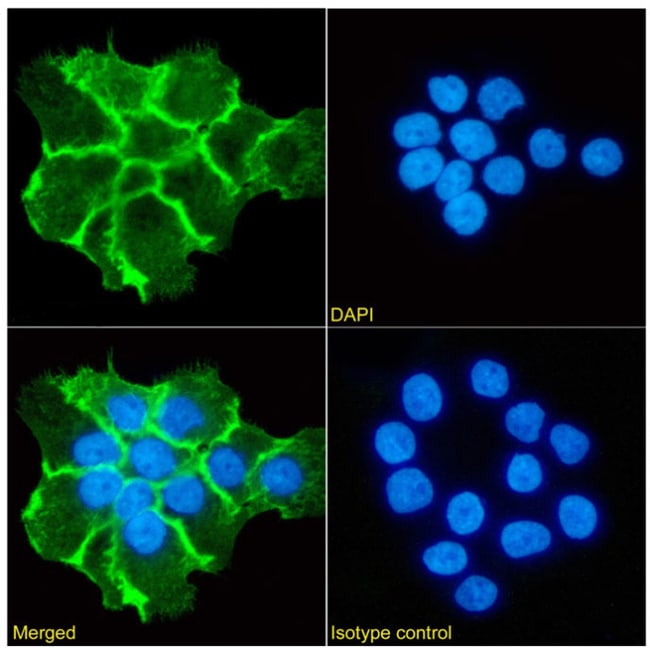 Invitrogen Zalutumumab Chimeric Recombinant Rabbit Monoclonal Antibody ...