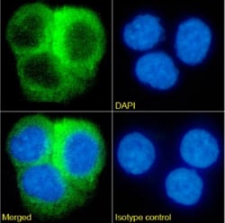 Invitrogen&trade;&nbsp;CRP Chimeric Recombinant Rabbit Monoclonal Antibody (P03)