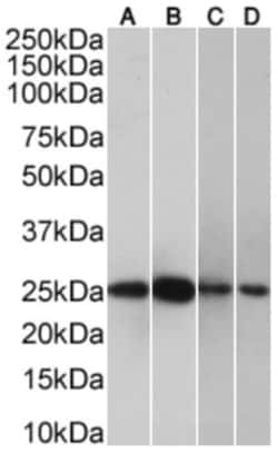 Invitrogen CRP Chimeric Recombinant Rabbit Monoclonal Antibody (P03) 200 &mu;g | Buy Online | Invitrogen&trade; | Fisher Scientific