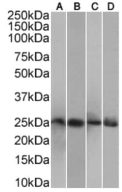 Invitrogen CRP Chimeric Recombinant Rabbit Monoclonal Antibody (P24) 200