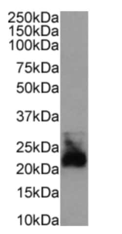 Invitrogen CD52 Chimeric Recombinant Rabbit Monoclonal Antibody (CF1D12) 200 &mu;g | Buy Online | Invitrogen&trade; | Fisher Scientific